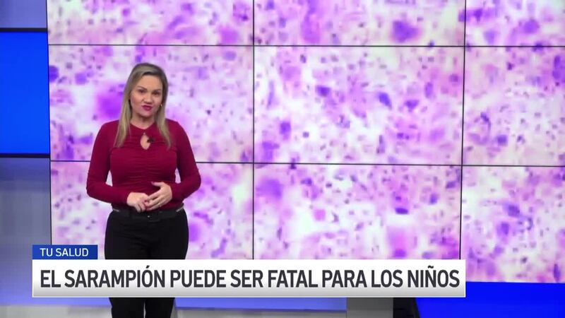 El sarampión es una enfermedad altamente contagiosa que afecta principalmente a los niños....